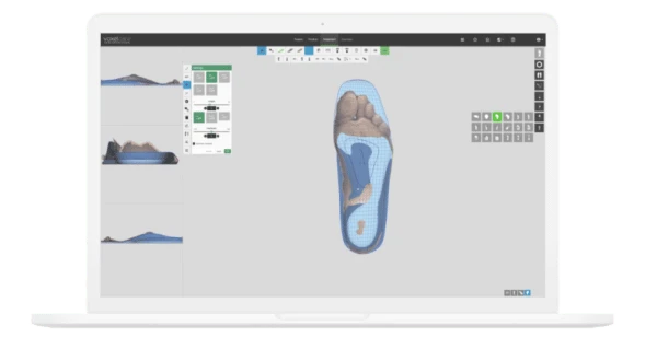 computer-modulieren-3d-scann-orhopaedische-einlagen