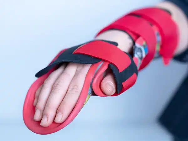 Individuell gefertigte Handorthesen-ergonomic-care-sanitätshaus München