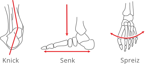 knick-senk-spreizfuss